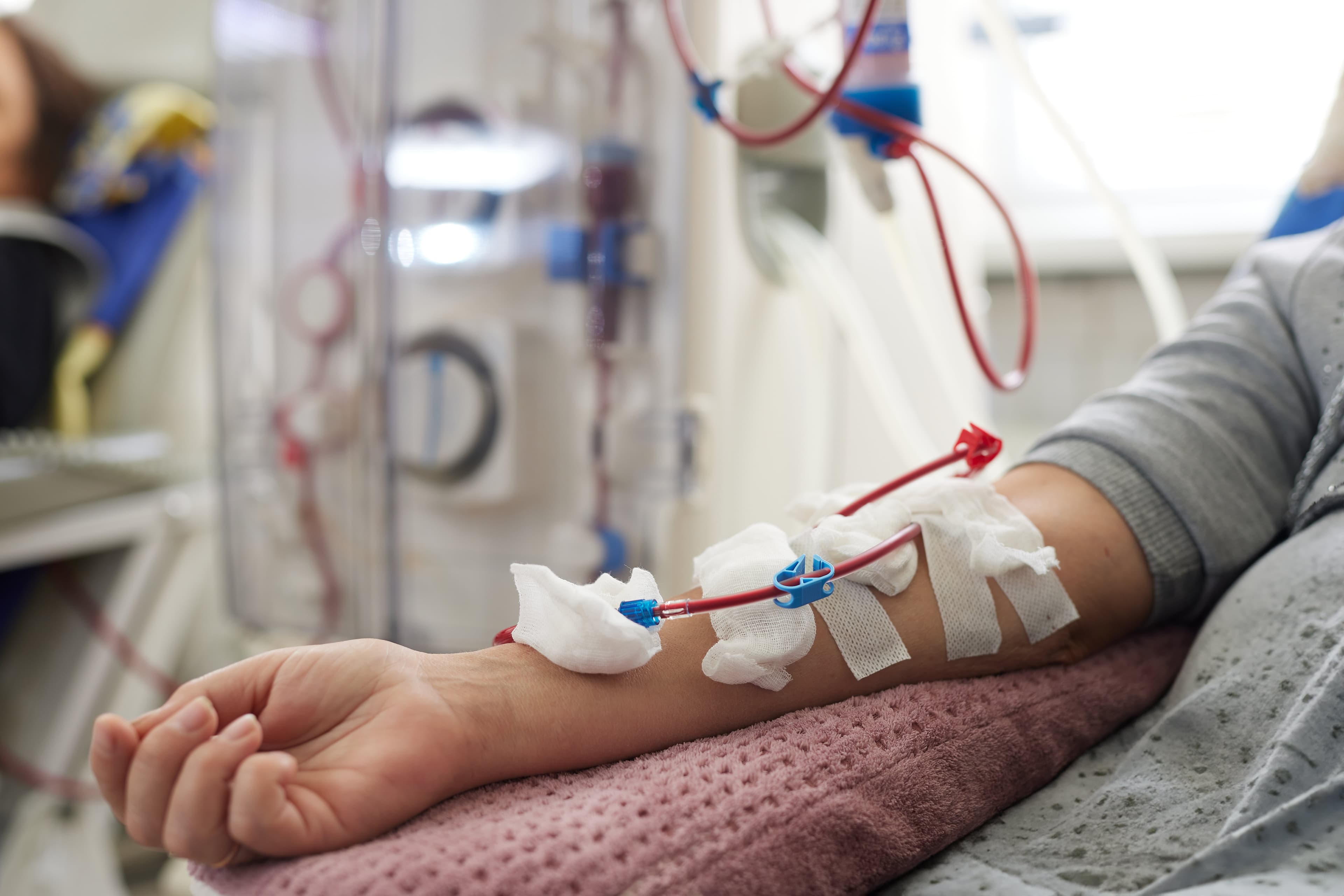 Dialysis